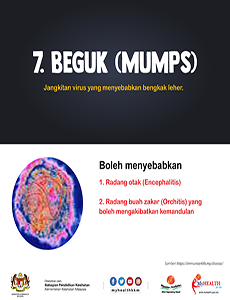 Beguk (Mumps) - infografik 7